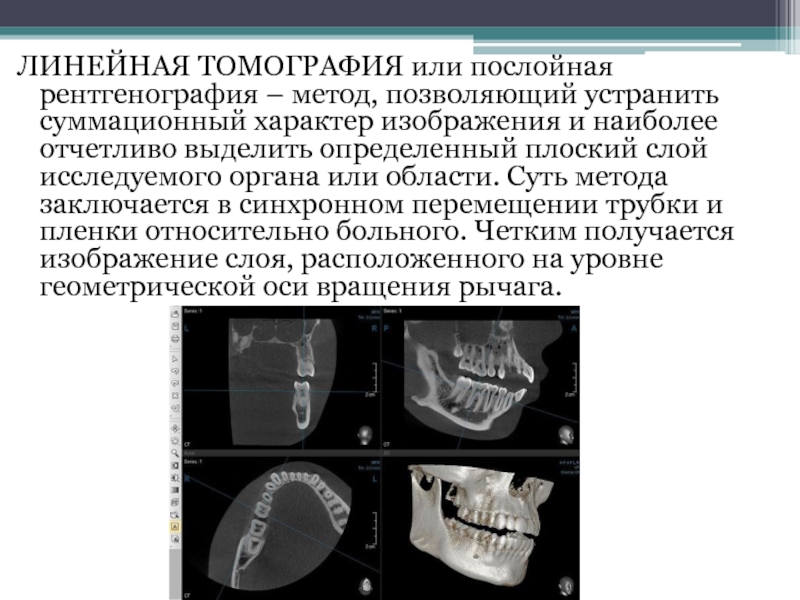 Проявочный автомат для обработки рентгеновской пленки или система для компьютерной радиографии