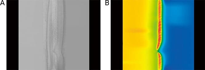 Comparison of bead shape detection in tailored blank welding